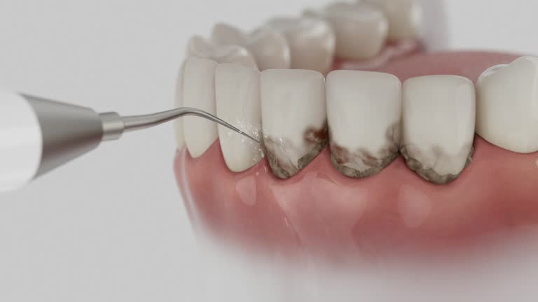 Reliable Dental contractor in Halesite, NY by Smile Center Dentistry